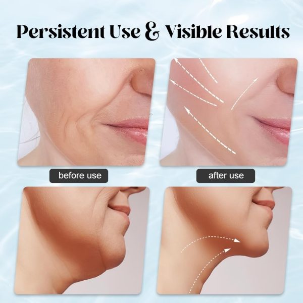 Massager For Face Lifting Facial Massagers Ems Neck Eye Massage Instrument Vibrator Microcurrents Red Light Therapy Anti Wrinkle – Random Color